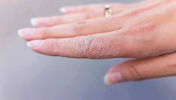 Провисання шкіри на руках - це не проблема. ТОП - 5 найпростіших і найефективніших вправ для верхньої частини рук